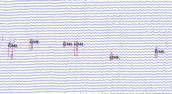 漏磁內(nèi)檢測(cè)